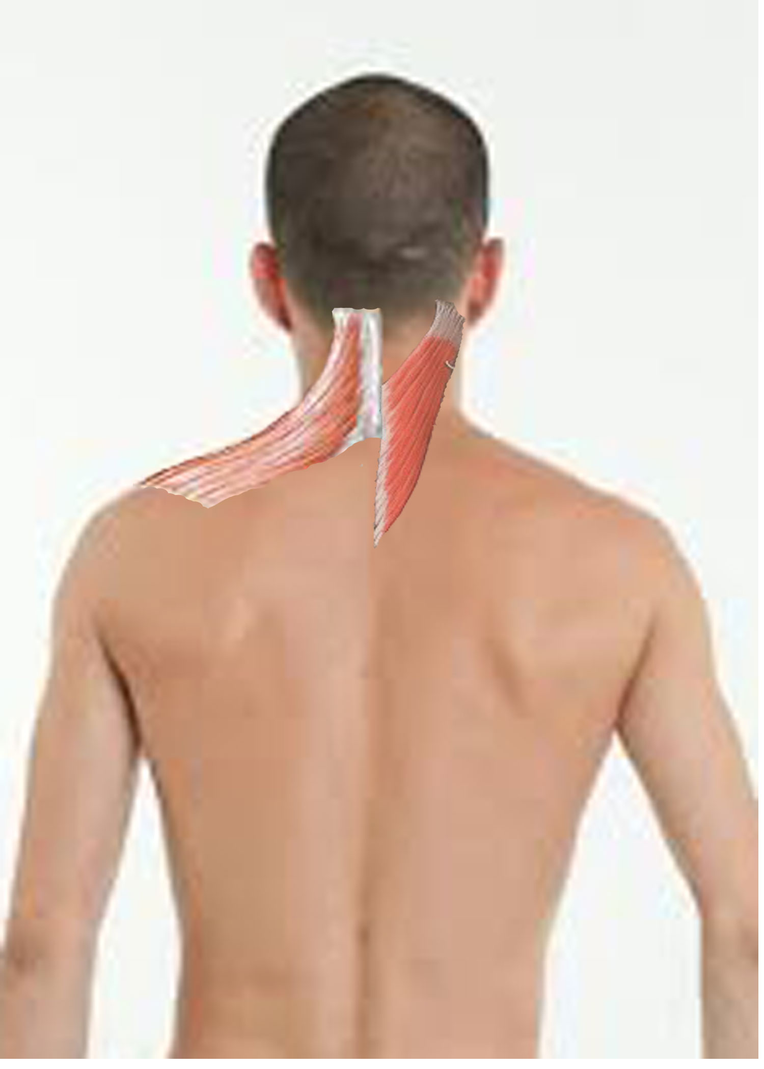 Self massage techniques for neck pain