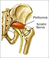 Get SCIATICA RELIEF now with massage! By relaxing the piriformis muscle of  the glutes with massage, pressure can be released off the…