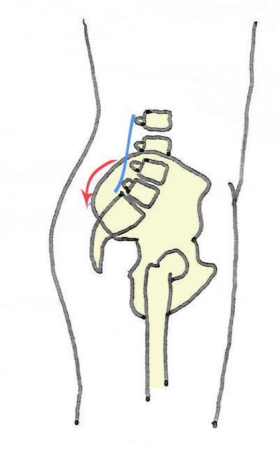 posterior-tilt-pelvis